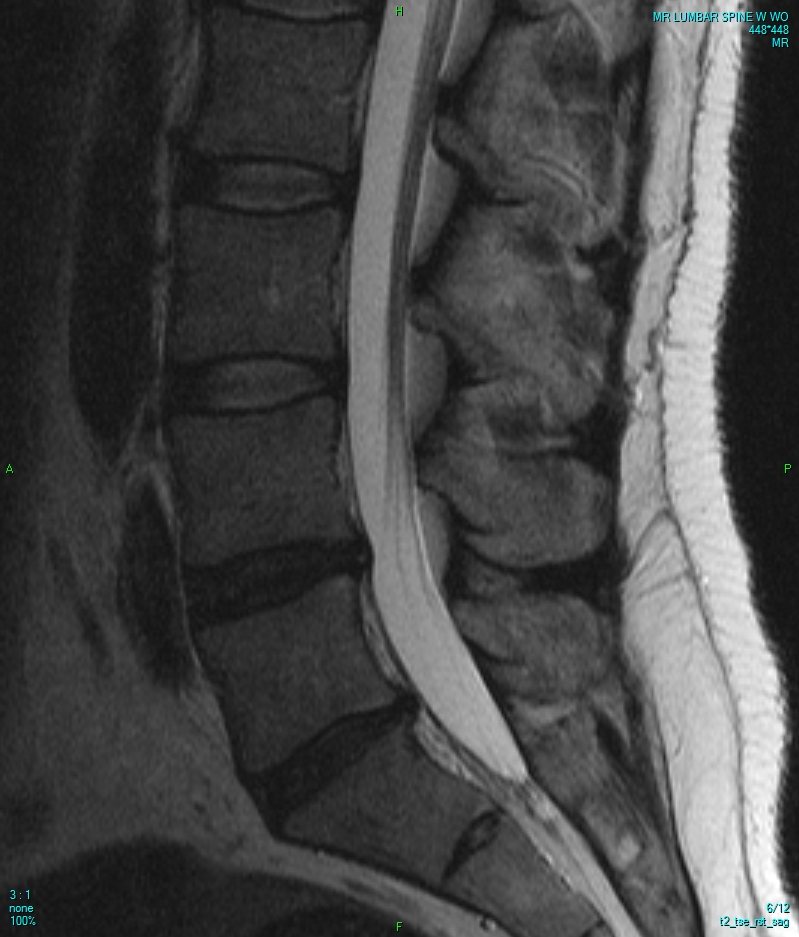 외부 공개 참고용 요추 MRI 영상