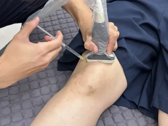 초음파 유도 약침